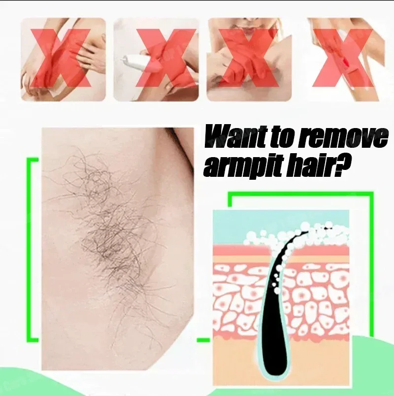Haarentfernungsspray Kraftvoll – Hair Care Korean Products Bewertung und Preis
